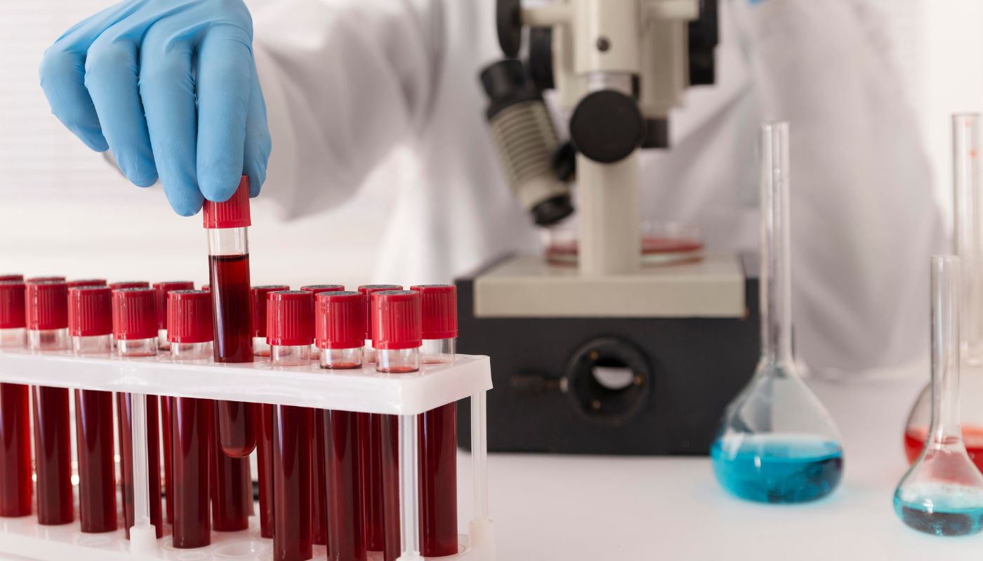 Stem Cell Blood Donation: Peripheral Collection Methods and Modern Techniques