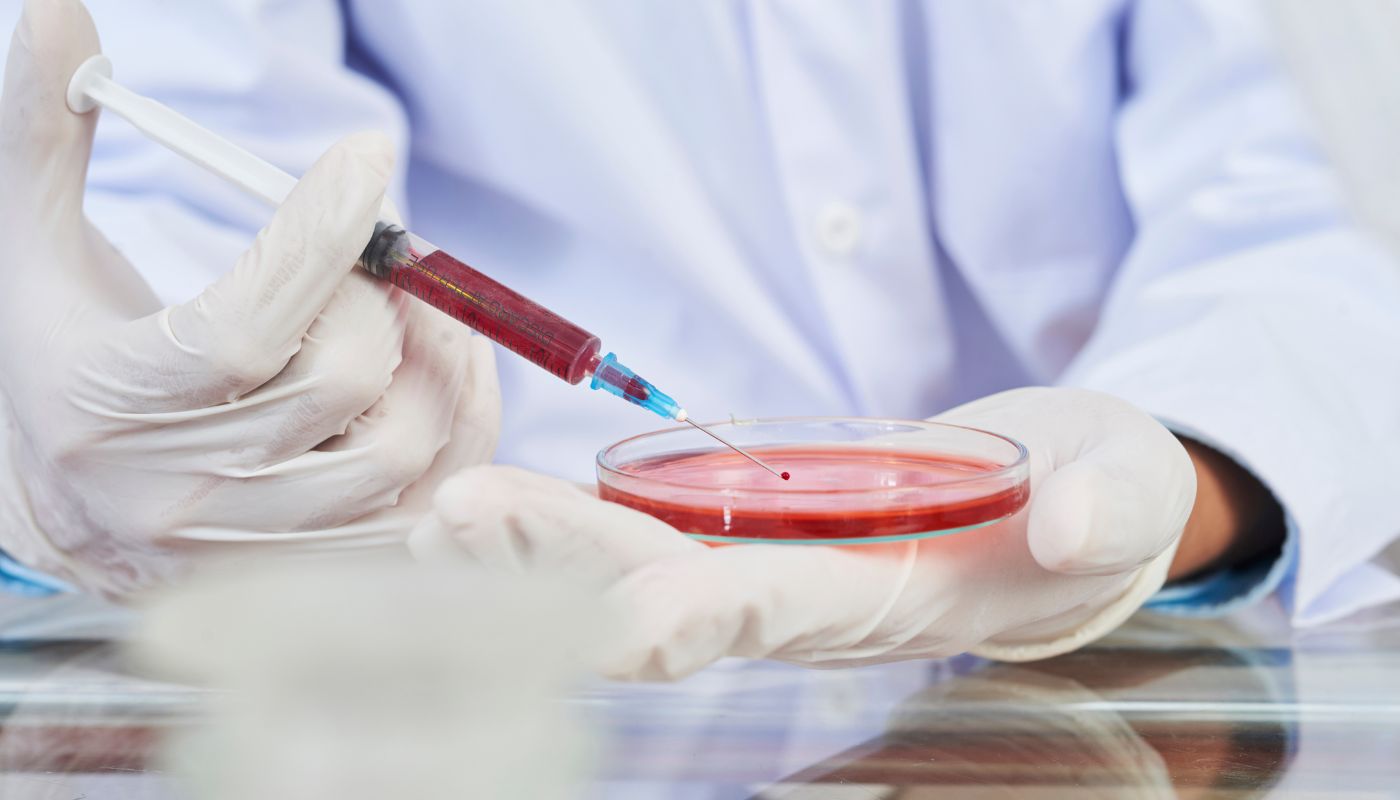 Stem Cell Donation Procedure: Step-by-Step Process